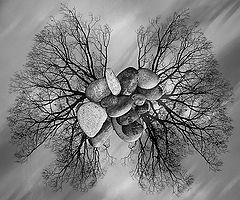 photo "Chest X-Ray"
