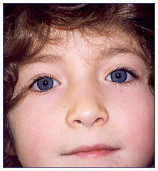 фото "Blue eyes girl"