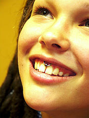 photo "Smile-pirecing"