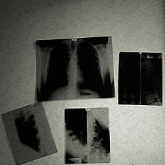 photo "X-Ray Kitchen"