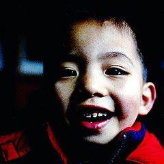 photo "nephew with decayed teeth"