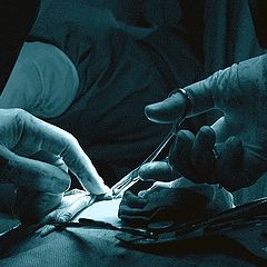 photo "Surgical hands"