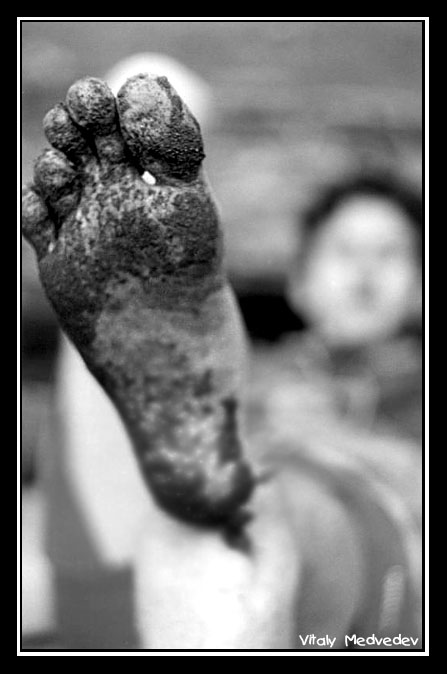 photo "A foot" tags: macro and close-up, black&white, 