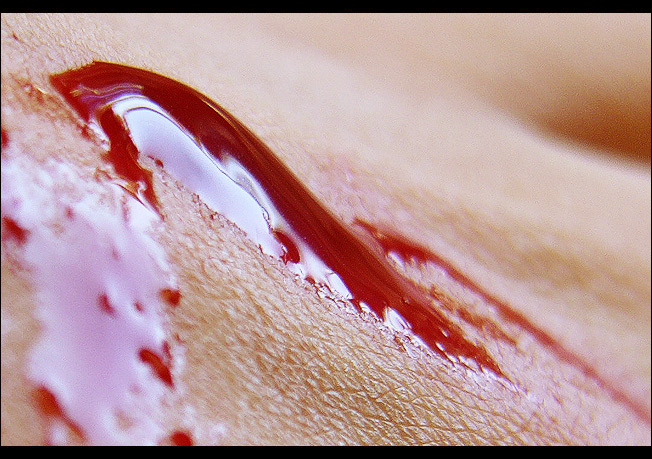 photo "skin & blood" tags: macro and close-up, abstract, 