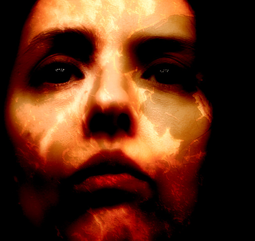 photo "Burn and Heal" tags: portrait, woman